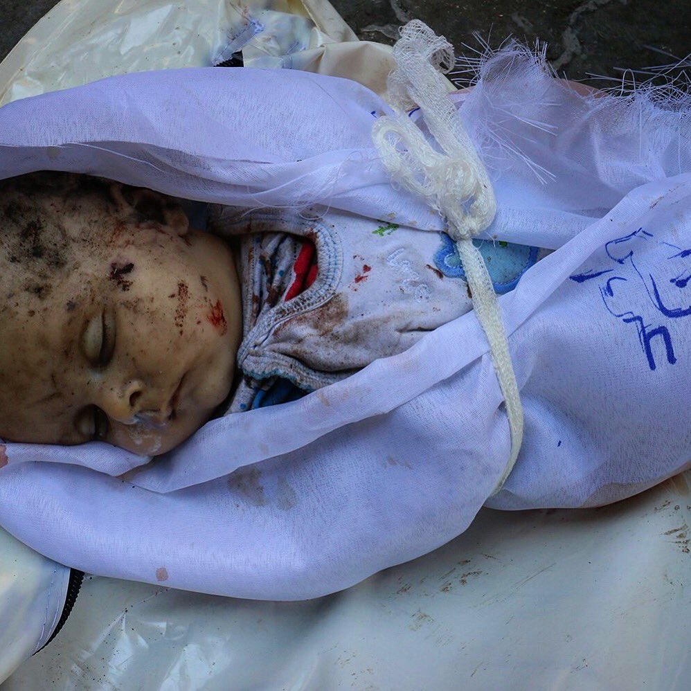 sakirkhader's tweet photo. I can't even imagine, the things this Syrian man is going through right now. https://t.co/ldWL0vFCuC