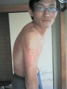 日焼けのイタズラには要注意ｗハシャギすぎると何年も痛い目みるよｗｗｗ