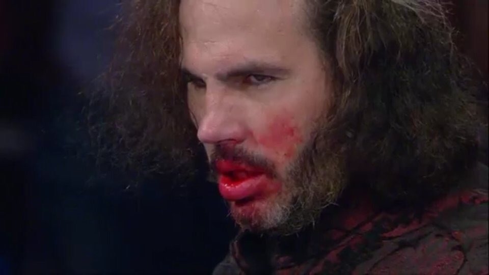 Resultado de imagem para broken matt hardy