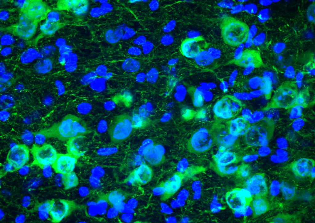 Interstellate (@interstellate_) on Twitter photo The print magazine version of <a href="/Interstellate_/">Interstellate</a> is at 85% capacity (65 pgs!). We have space for a couple more images! The print magazine version of <a href="/Interstellate_/">Interstellate</a> is at 85% capacity (65 pgs!). We have space for a couple more images!