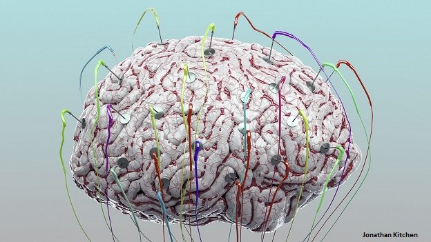 A brain wired up to sensors for testing