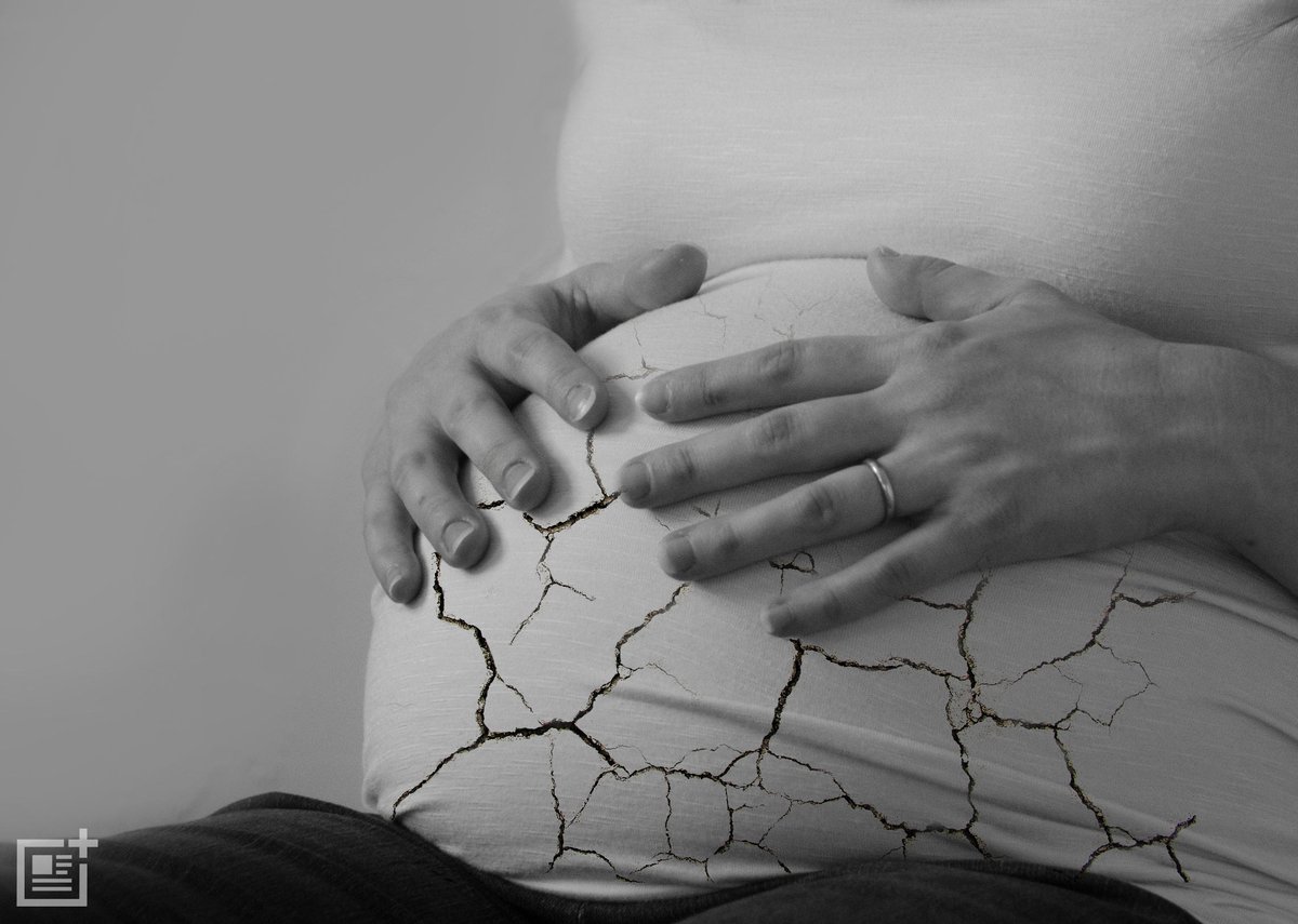 healthunits's tweet image. Paracetamol During Pregnancy May Cause Behavioral Problems In Child
#BehavioralProblems
bit.ly/2bwbYOe