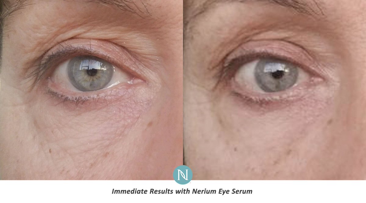 Lib4Health's tweet image. Wake up looking and feeling refreshed with Nerium Age-Defying Eye Serum!