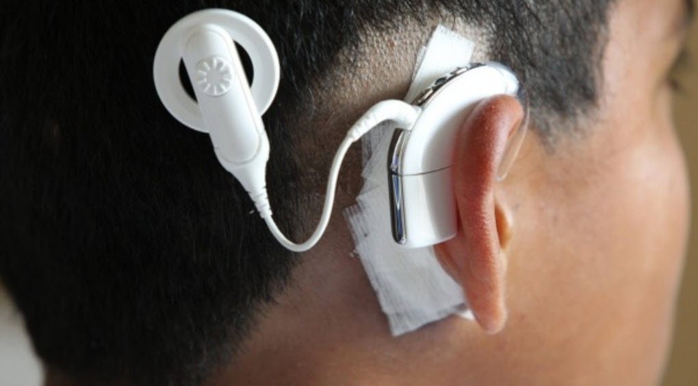 FinancialReview's tweet photo. .@CochlearAsiaPac locked in Chinese discounting war $COH @AngusGrigg @lmurray75 https://t.co/1wvvAlVHqD https://t.co/YqLNENVdan