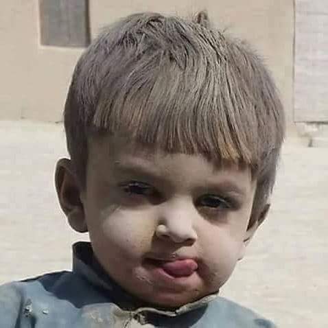 zxcahmd1995's tweet photo. هذاالطفل اليمني خرج من بين الانقاض متحدياًيقول :  (بحذائي يااال سلووول ). https://t.co/EfME04xHdS