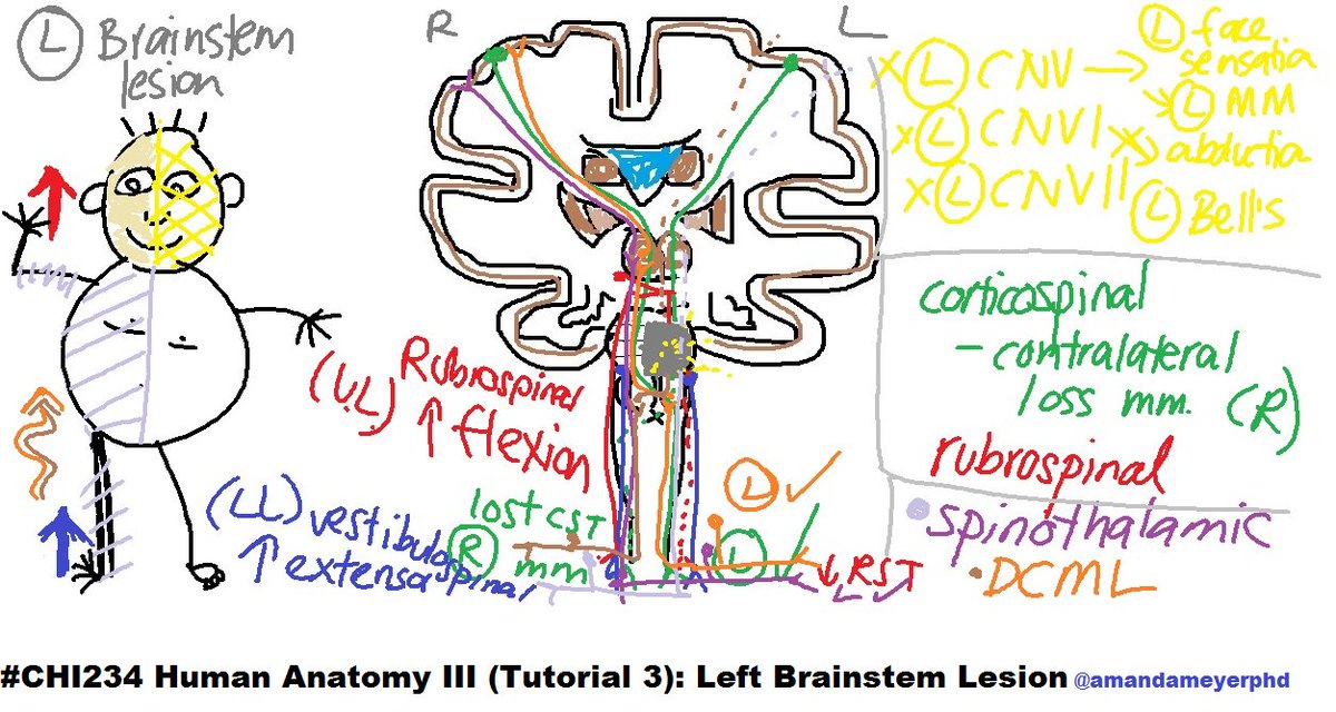 amandameyerphd's tweet photo. Last #neuroanatomy tutorials #CHI234. Went thru #brainstem &amp; #InternalCapsule lesions + effect on #SpinalCordTracts https://t.co/MQ05rEOTPA