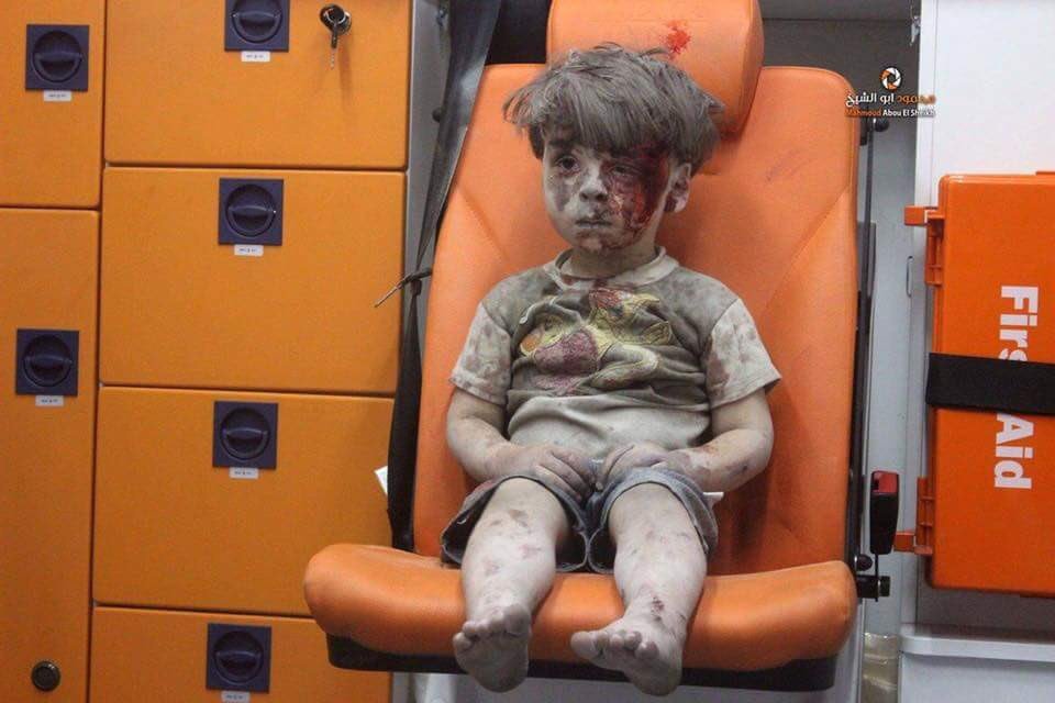 Doctor in #Aleppo just sent this photo  of a dazed child who survived an airstrike