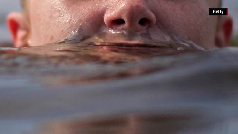 CNN's tweet photo. A fourth person this year has been infected with a brain-eating amoeba https://t.co/u4v3cXRfdg https://t.co/nvQzKuckfF