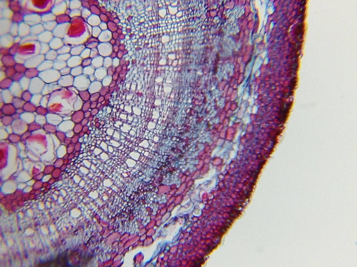 loveuhandy's tweet photo. stained vascular
#science #microscopic #uhandy #mobilemicroscope https://t.co/n5IVOX3VeV