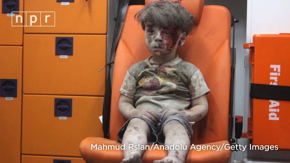 NPR's tweet photo. A haunting image of a Syrian boy, covered in blood and dust, has captured global attention. https://t.co/vIHMpxt6PO https://t.co/lWOSyvnUmU