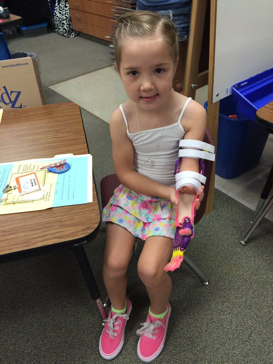 joyschwartz's tweet photo. Mady headed to K with one of her 3D printed prosthetics! My heart is full! @DremelEdu @Enablethefuture https://t.co/cf092Dn9dF