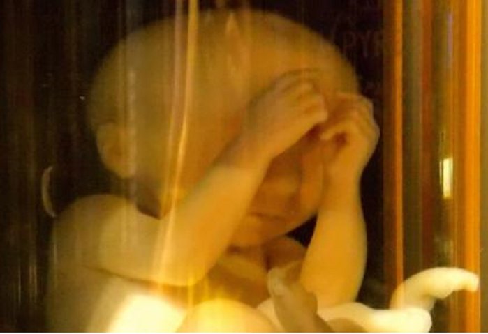 LifeNewsHQ's tweet photo. Planned Parenthood Likely Keeping Some Aborted Babies Alive “Until Their Hearts are Cut Out” https://t.co/pe6IZ0hyU1 https://t.co/L2vlh9Rc3I