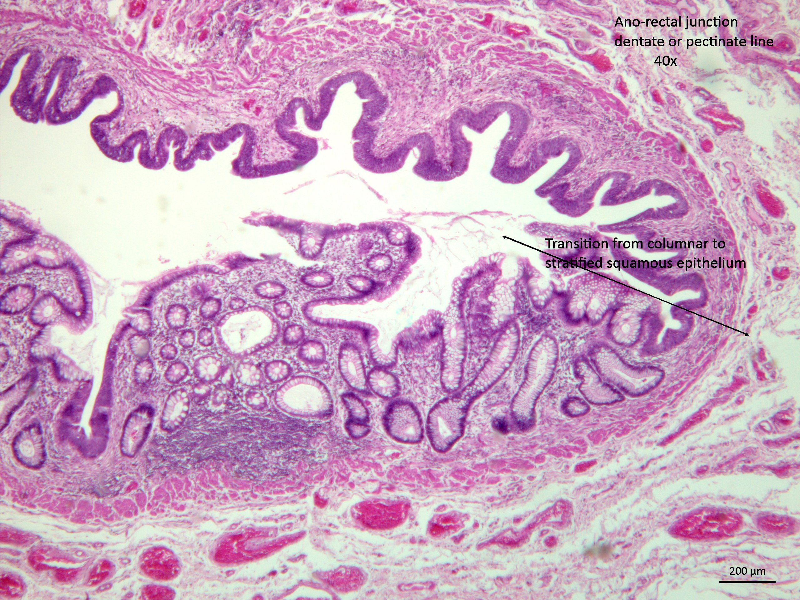 Taenia coli