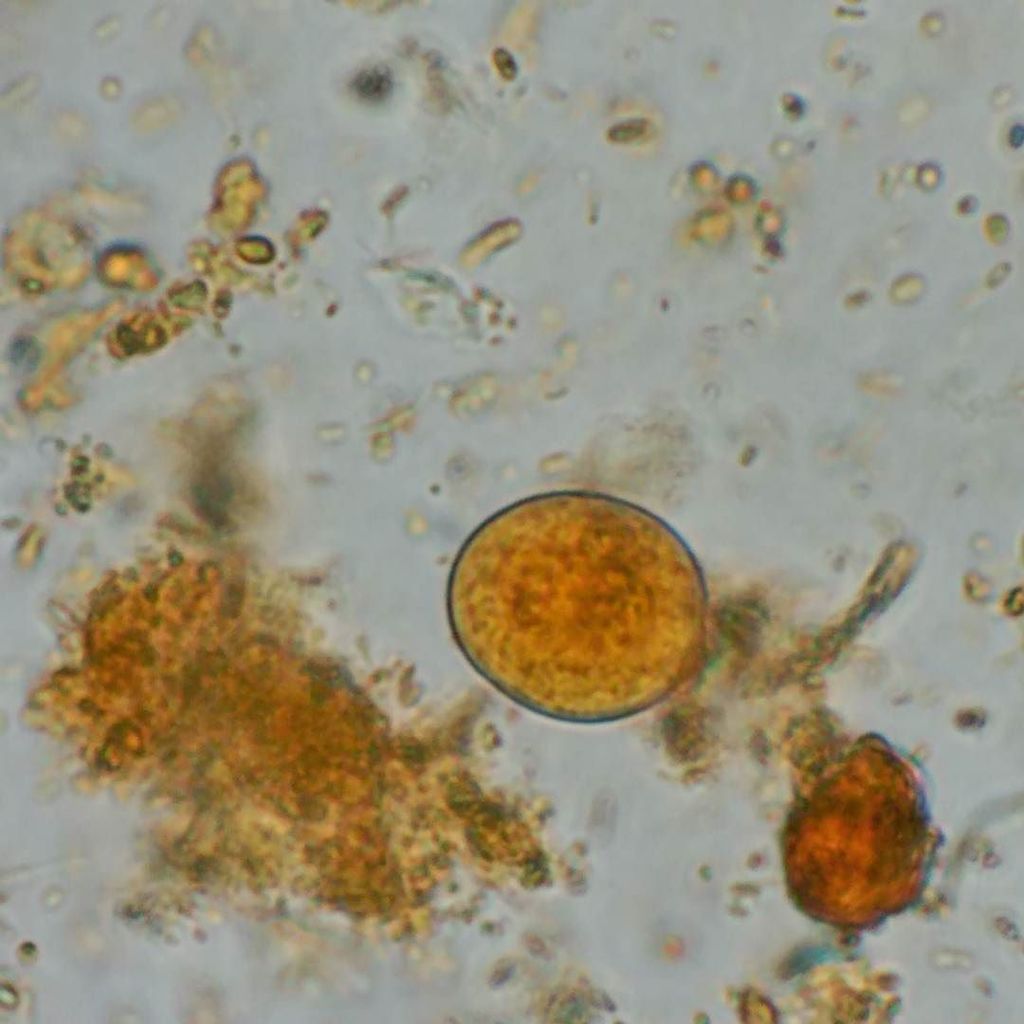 Споры в кале у взрослого. Цисты лямблий микроскопия. Цисты лямблий под микроскопом. Цисты лямблий микроскопия кала.