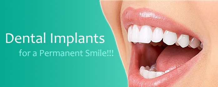 BrighterSmileGA's tweet image. RT @parkdentalc #denatl #dentist #dentalcare #dentalhealth #dentalimplants #dentalhealth #health #healthcare #duba…