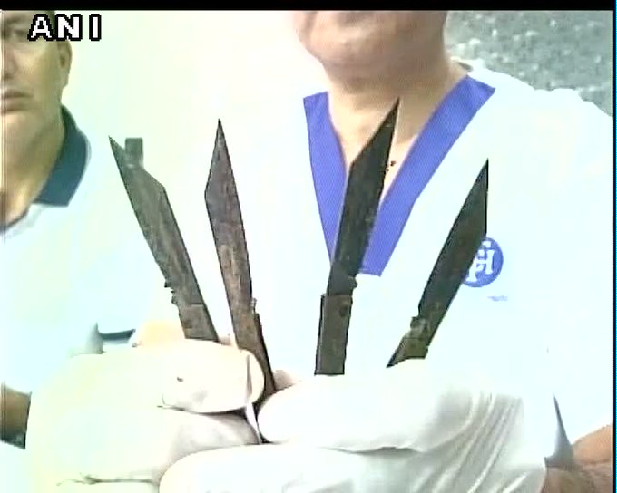 man eats 40 daggers but survived to tell the tale