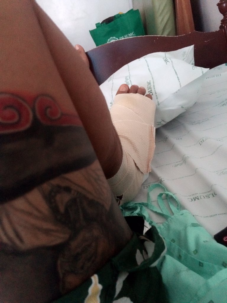 Hndi nko tinigilan ng injuries. I miss dancing. I miss work. I miss sex.