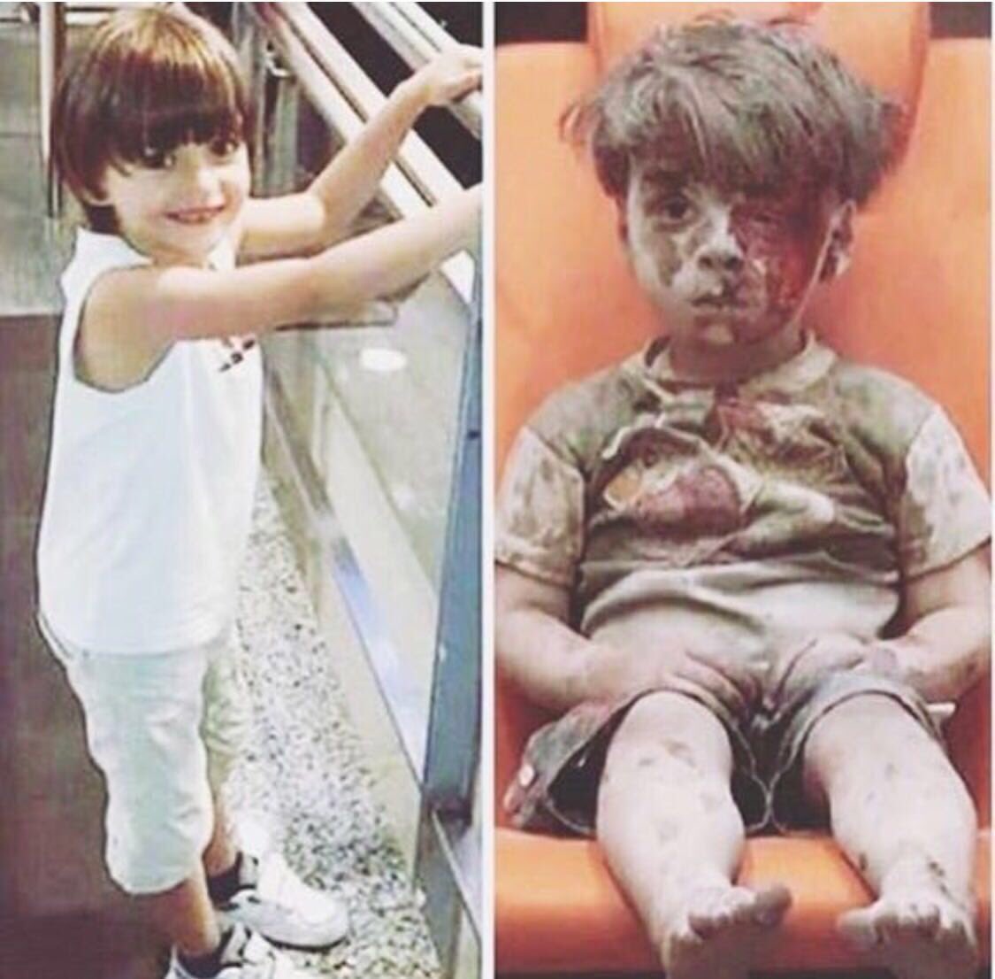 Almajlliss's tweet photo. الطفل عمران .. قبل وبعد !
#عمران_من_تحت_الأنقاض https://t.co/6UnPLuHIpy