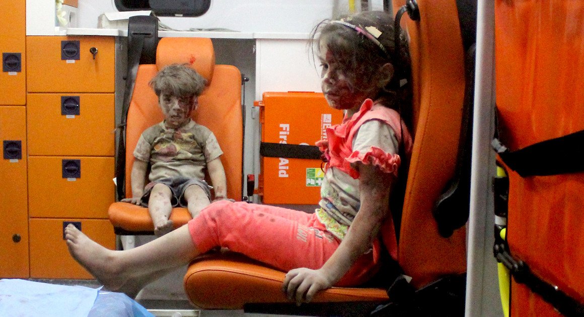 politico's tweet photo. Viral images of wounded Syrian children renew calls for action in the region https://t.co/4xRASjUd3x | Getty https://t.co/tNiOOudL4j