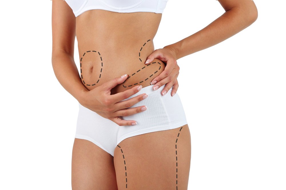 look_younger_'s tweet photo. Liposuction surgery
https://t.co/tL2BELZSj5
#aesthetictreatments
#TeamLosing
#lipedema
#Chichester #united_kingdom https://t.co/0xHmQUT4a9