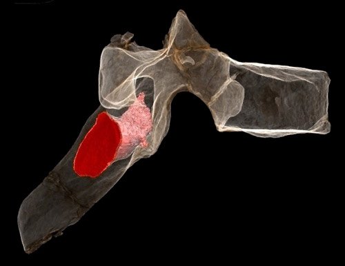 SAJS_Official's tweet photo. Earliest hominin evidence for #neoplastic disease #SedibasWorld #FossilCancer https://t.co/ZIXpTDTOeO https://t.co/I9cSlyrjWQ