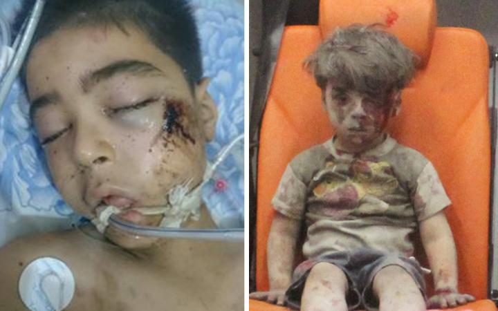 linternauta_it's tweet photo. Ali e gli altri bambini che non fanno notizia https://t.co/dWrXmiYhim #Siria, #ONG, #guerracivile, #bambini, #Aleppo https://t.co/TZNvrDGzGV