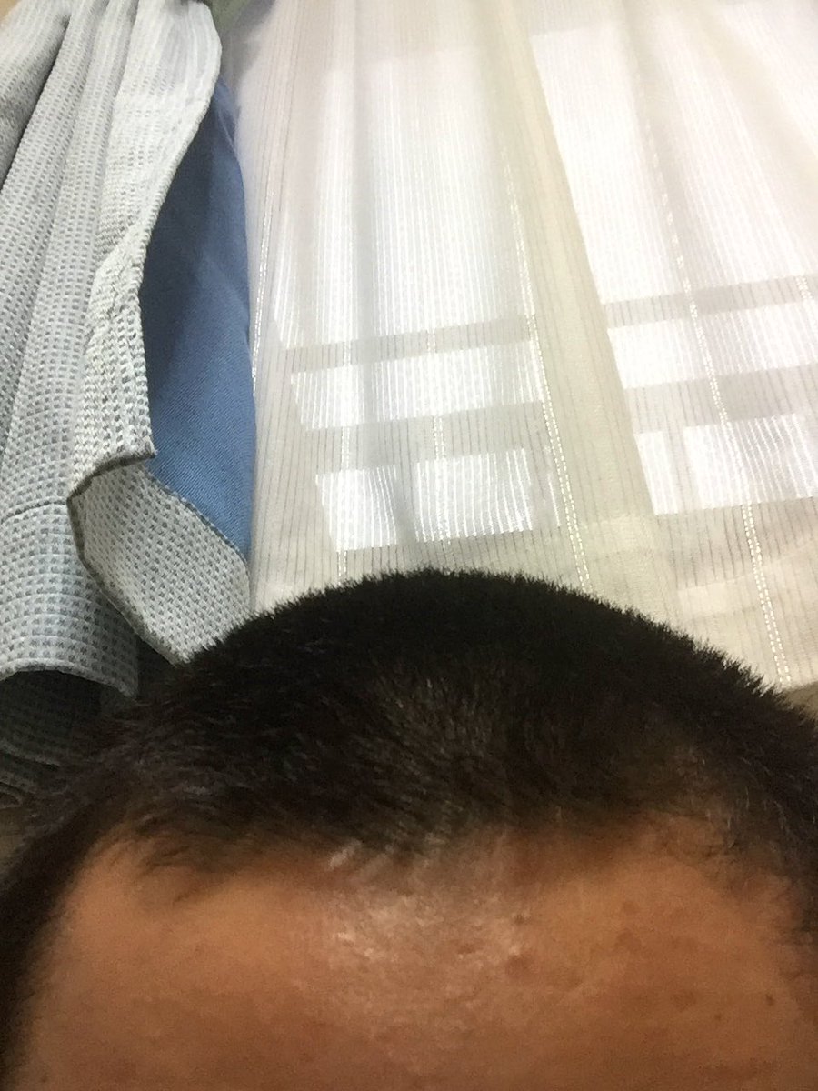 おしゃれ坊主