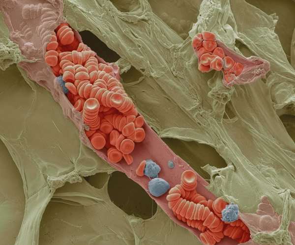 cateterdoblej's tweet photo. El interior de un pequeño vaso sanguíneo visto con #microscopio SEM. Imagen de Steve Gschmeissner https://t.co/mUh3ByAFZ7