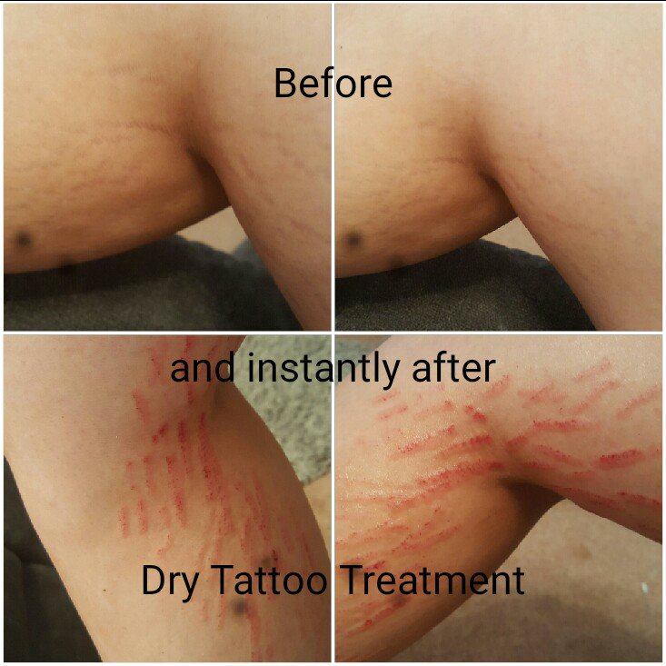 Dry Skin Tattoo How To Properly Heal Your Tattoo When Its Drying