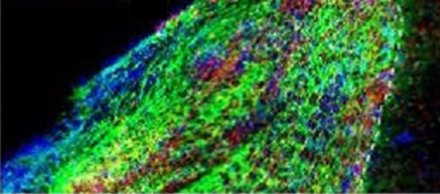 NIH_NINDS's tweet image. Stem cell therapy heals injured mouse brain bit.ly/2bM1j20 @NIH