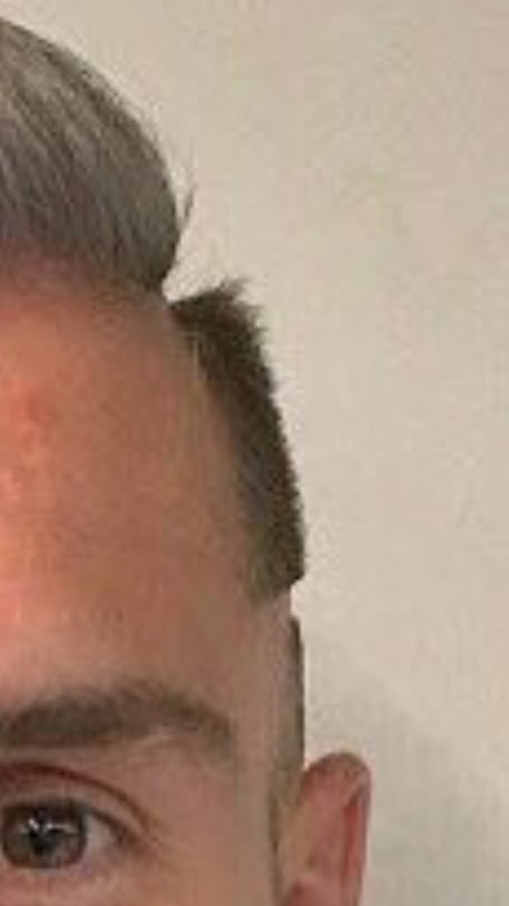 SundayChants's tweet photo. Views from Ramsey's new haircut. 😂 https://t.co/fU4AtlkRH5