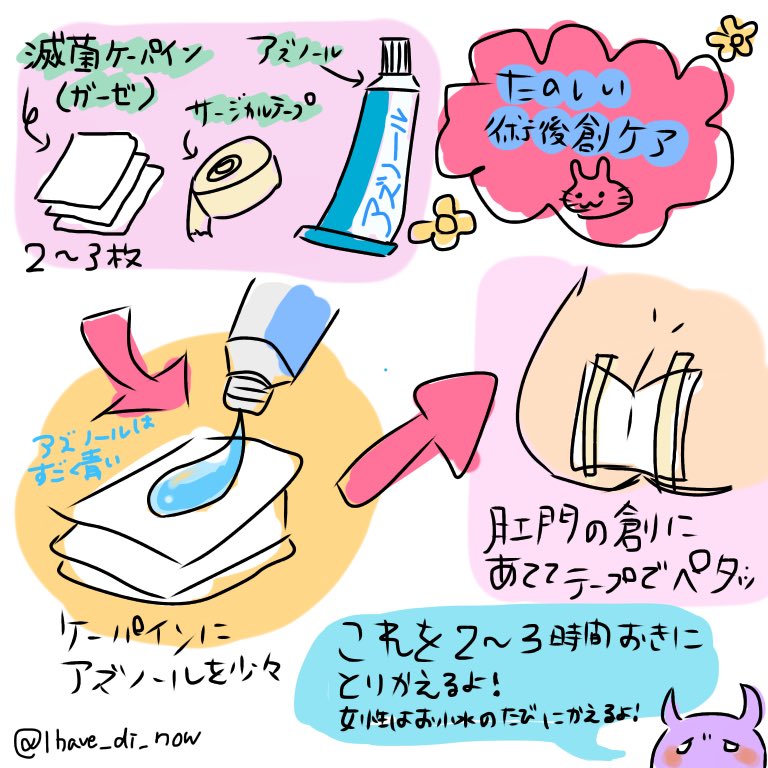 38 術後1年半 痔瘻 切 イボ痔 בטוויטר 痔瘻手術後1日目から指導いただいてはじまったセルフケアの内容 ちなみに手術の方法は幹部 裂孔 痔ろう をくり抜いてからの シートン法 でした 痔 手術 痔ろう 裂肛 切れ痔