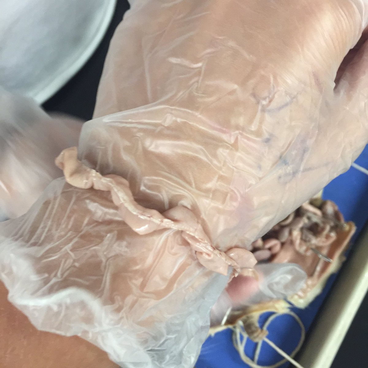 maggiemcgil's tweet photo. My intestine bracelet https://t.co/wnY6VK8bGW