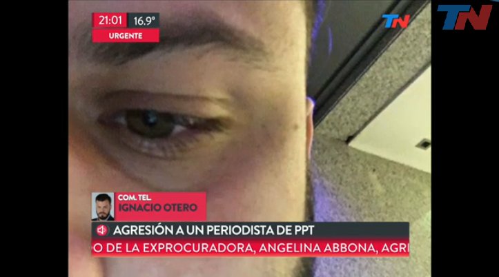 fernandocarnota's tweet photo. #TNCentral https://t.co/rNgBkqfXrb