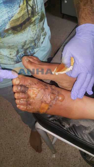 Ver imagem no Twitter