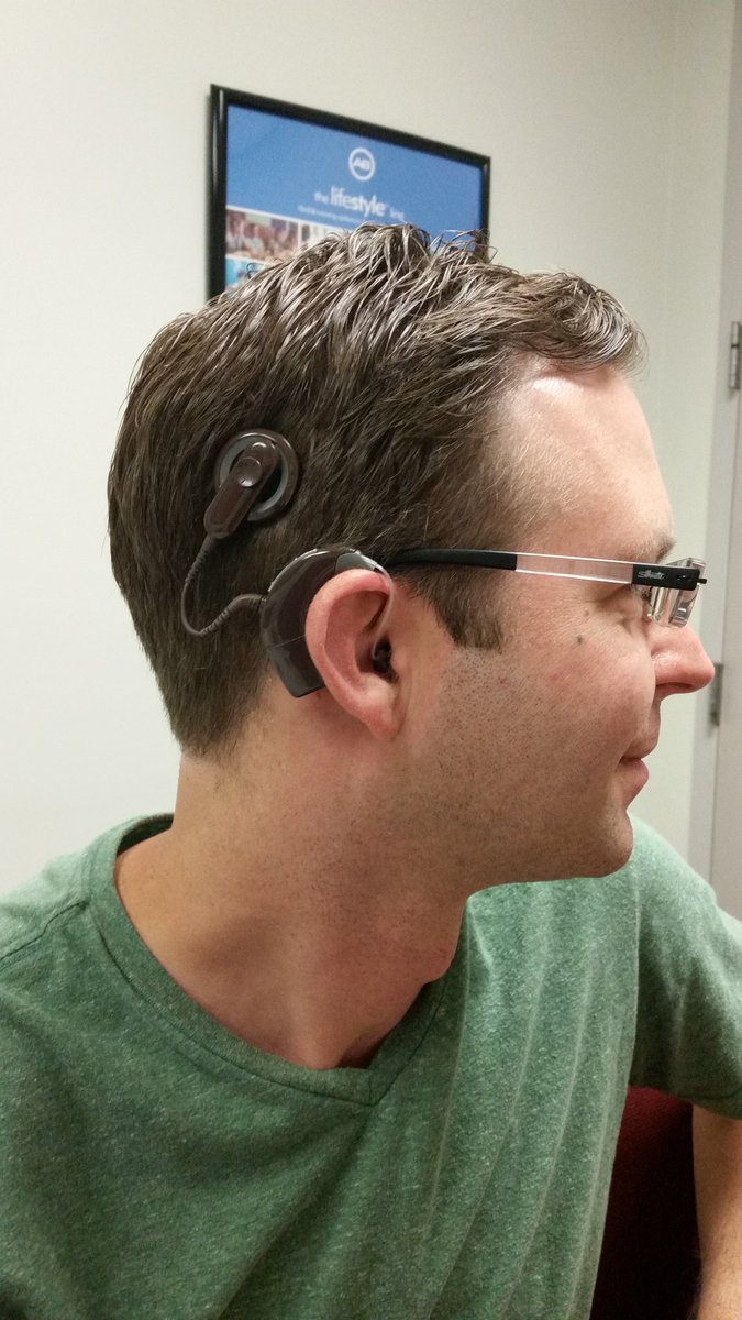 MathCancer's tweet image. I am a fully activated cyborg. #CochlearImplant #BionicEar