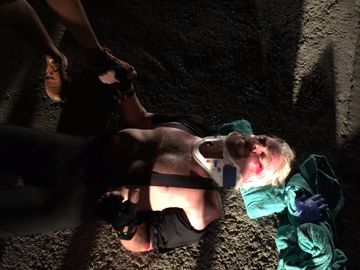 My life flashed before my eyes – fell headfirst over my bike handlebars virg.in/JPxtm