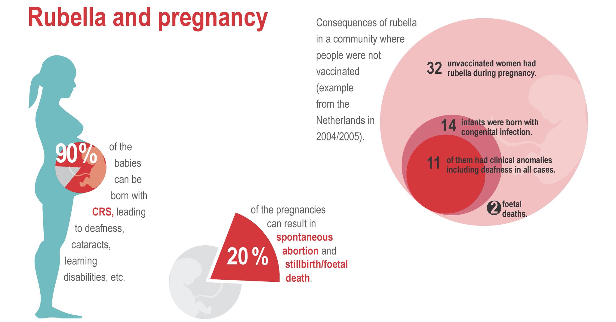 “#Rubella during pregnancy can lead to congenital anomolies &amp; f...