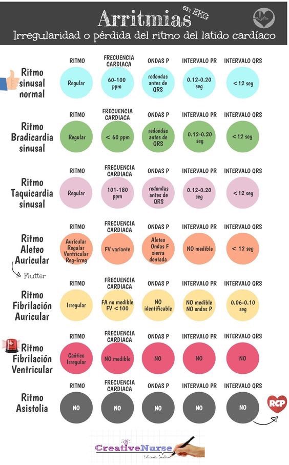 infermeriaIG's tweet photo. Las #arritmias que #enfermeria encuentra en los #ECG #EKG , vía @Creative_Nurse https://t.co/06CP42ZlVS