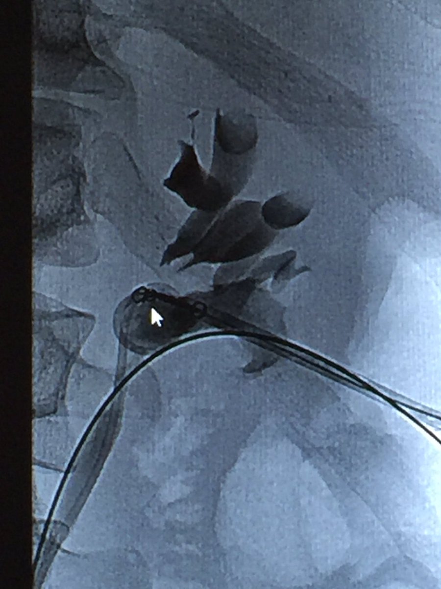 Ahmed Kamel MD, PhD, FSIR tweet media