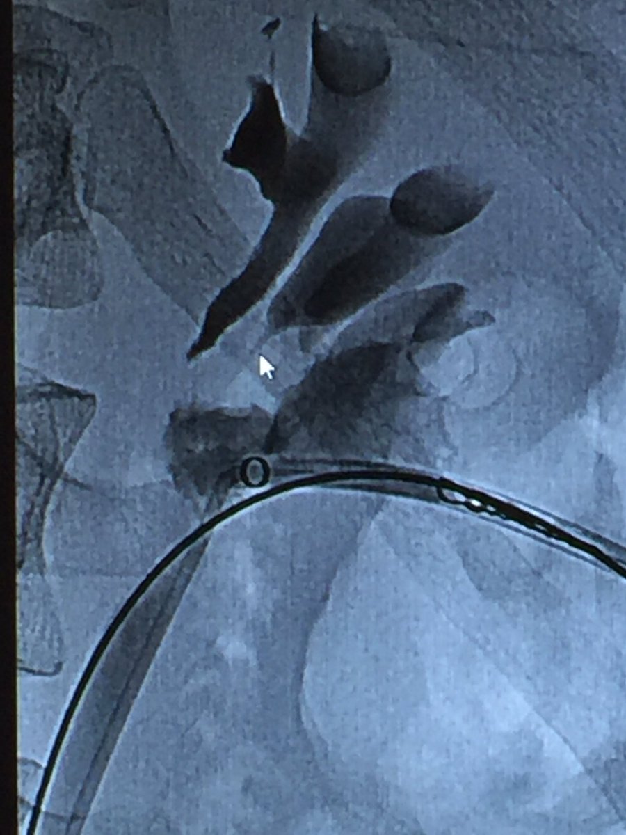 Ahmed Kamel MD, PhD, FSIR tweet media