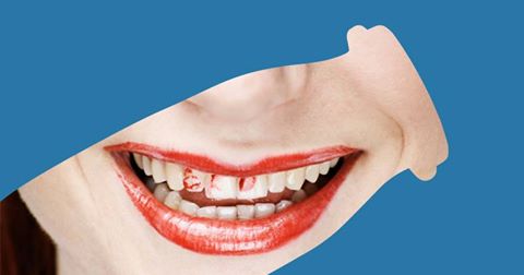 DanActiveCA's tweet photo. Quand ton rouge à lèvres est plutôt un rouge à dents. #BravezLaJournée https://t.co/QurRRpZjnl