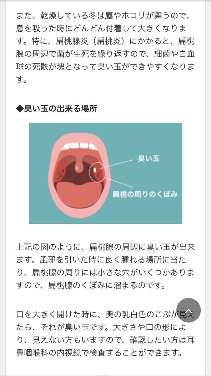 ない 臭い 玉 見え 口からでてくる臭い玉（膿栓）の原因や改善法を紹介！口臭にも関係あるって本当？