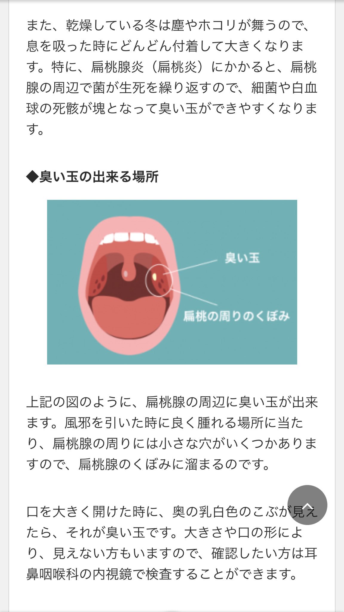 Twitter 上的 ひで 1ヶ月半位前から自分がなんか臭いな レッドブル飲むと味が変わったかと思ったりしてたのはこの臭い玉だわ 扁桃 炎だと出来やすくなるんだって 最近ひでが臭いなと感じてた皆さんは扁桃炎が完全に治るまで我慢してやってください T Co