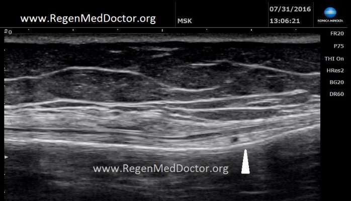 URMEducation's tweet photo. One Spot left for Sept 17-18 Hands On Ultrasound Course! Call 615-495-4000 to reserve the last seat. https://t.co/GsYAHfaYOg