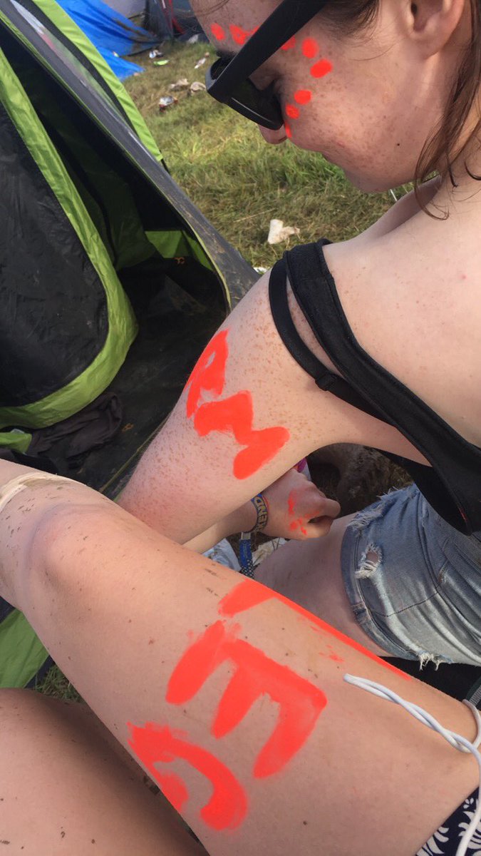 eleanorpc_'s tweet photo. pops is the love of my life #armleg https://t.co/mLpnk7I60r