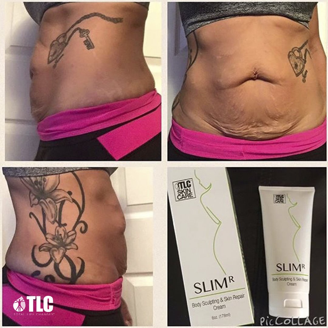TLCHQ's tweet photo. Our #SlimR thermogenic body sculpting cream can help smooth skin and even skin tone! https://t.co/o19xmwrXVT https://t.co/smRdzCJLe1