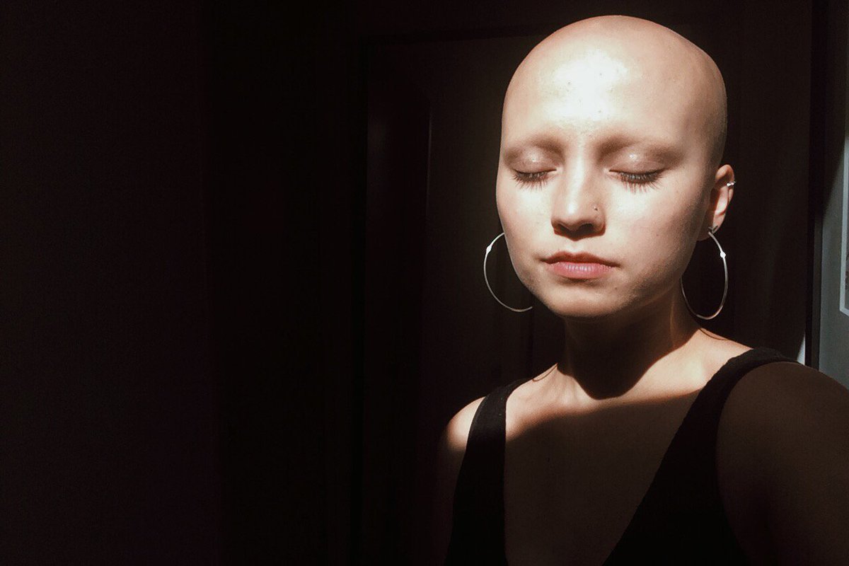 allkindsofhuman's tweet image. . @LennoxBishop is defining her own beauty standards. Read her #TrueStory: vs.co/eLC6IQ