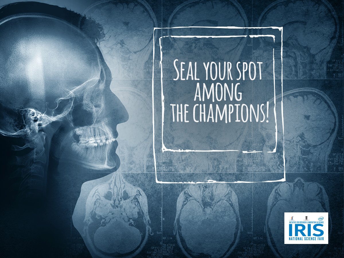 IRISNational's tweet image. Join our alumni community:  bit.ly/2aPBpsI #IntelIRIS #IamIntel