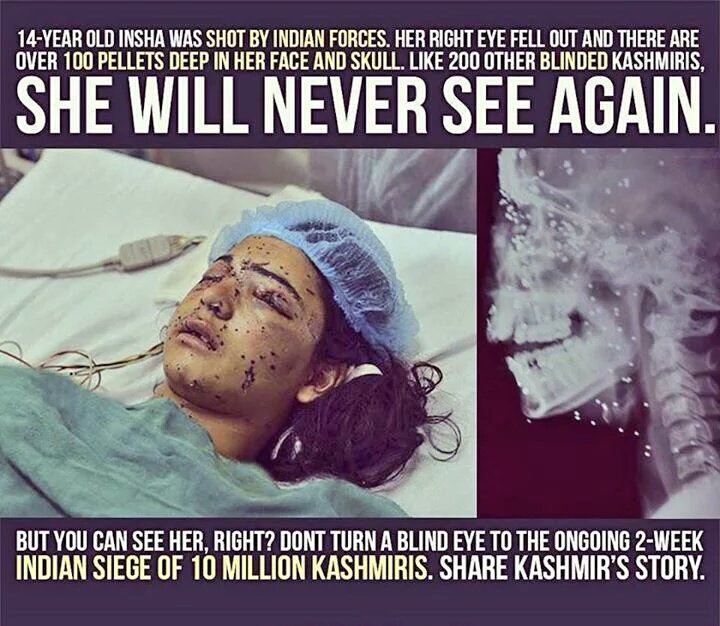 A_MateenAnsari's tweet photo. بینائی سے محروم کشمیریوں کو کیا گیا اور اندھے مسلم ممالک کے حکمران ہو گئے ہیں جنہیں ظلم نظر نہیں آتا
#YearOfDeadEyes https://t.co/ns4GE7pewu
